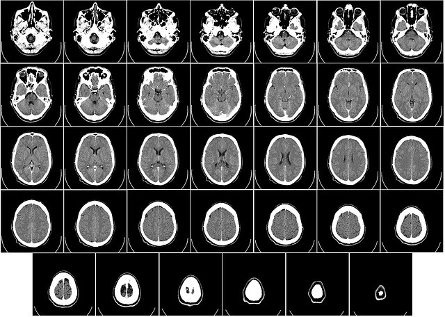 מה ההבדל בין CT לבין PET CT?